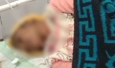 19 साल की विवाहिता ने किया सुसाइड का प्रयास:जहर खाया, अस्पताल में भर्ती, मां ने ससुरालियों पर दहेज प्रताड़ना के लगाए आरोप