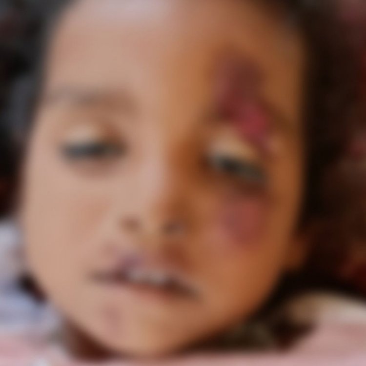 मां के हाथ से छूटी बच्ची ऑटो से गिरी, मौत:परिवार के साथ जा रही थी, सिवनी में मेहता गांव के पास हादसा