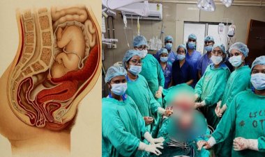 छत्तीसगढ़ का पहला मामला : मेकाहारा में दुर्लभ प्रेग्नेंसी का सफल ऑपरेशन, गर्भाशय में नहीं पेट में पला भ्रूण, मां और शिशु दोनों सुरक्षित