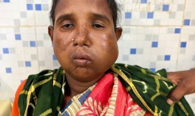 संजीवनी बना मेगा सुपर स्पेशलिटी हेल्थ कैंप