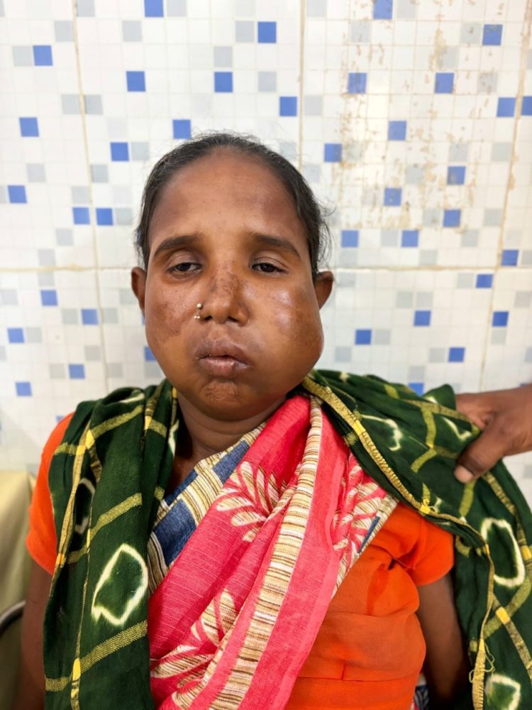 संजीवनी बना मेगा सुपर स्पेशलिटी हेल्थ कैंप