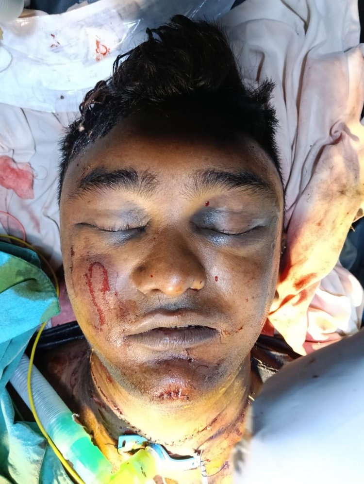 सिम्स में डॉक्टरों ने बचाई युवक की जान : गले की कटी श्वासनली की आपातकालीन सर्जरी कर दिया नया जीवन