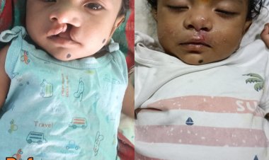 चिरायु टीम की तत्परता से तीन माह के मासूम को मिली नई मुस्कान